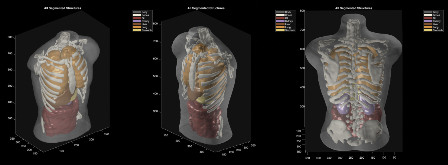 Midjourney unveils its first hardware product, the Midjourney Scanner, an ultrasound-based full-body scanner; it is unclear how AI fits into the medical effort